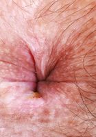 Violet Viper Hairy Pussy Spreading, Violet Viper (vio031) ATK Natural & Hairy: Violet Viper (Violet Viper Hairy Pussy Spreading)